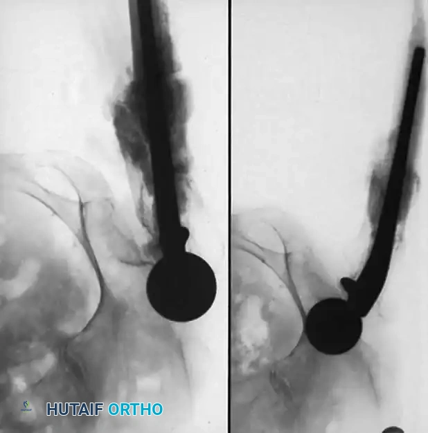 Hutaifortho's Orthopaedic Diagram