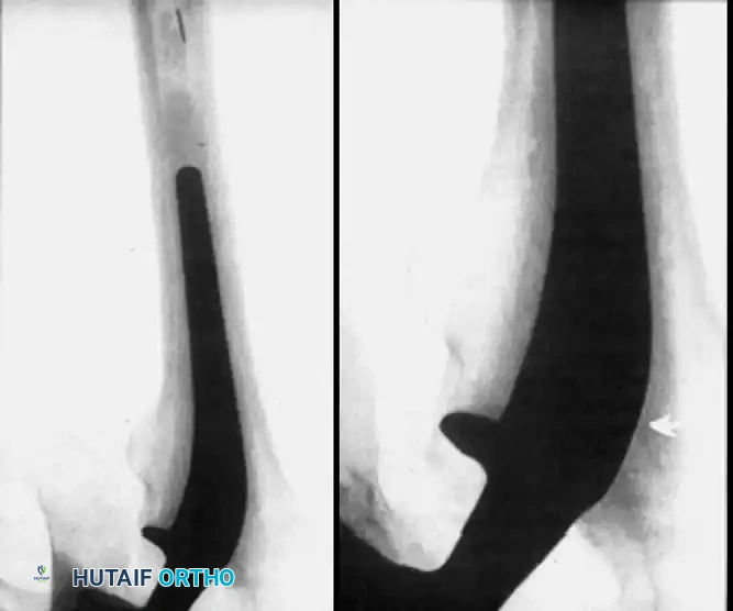 Hutaifortho's Orthopaedic Diagram