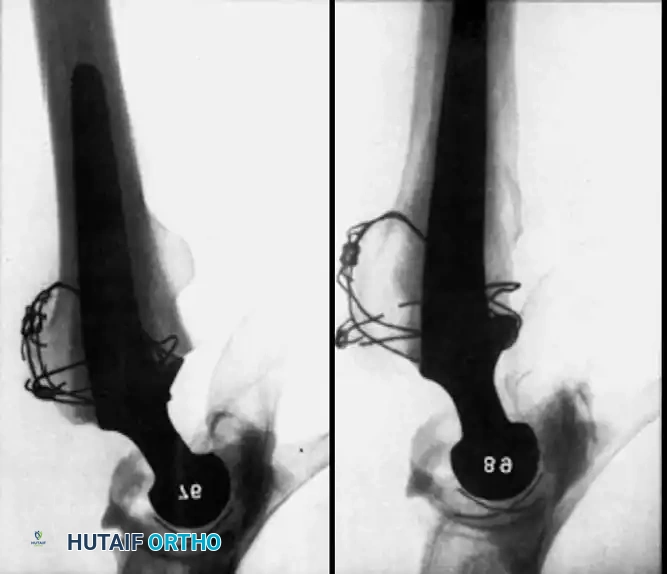 Hutaifortho's Orthopaedic Diagram