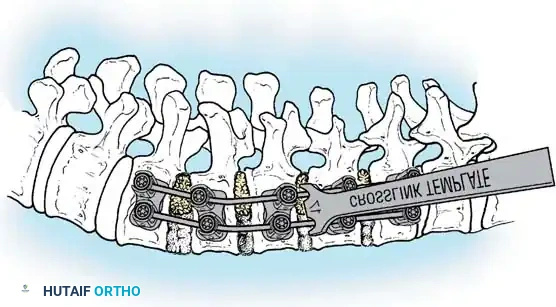 Hutaifortho's Orthopaedic Diagram