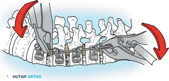 Hutaifortho's Orthopaedic Diagram