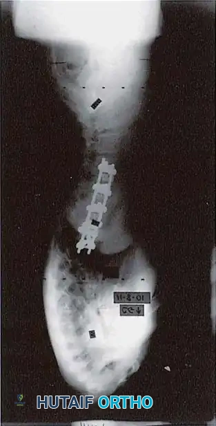 Hutaifortho's Orthopaedic Diagram