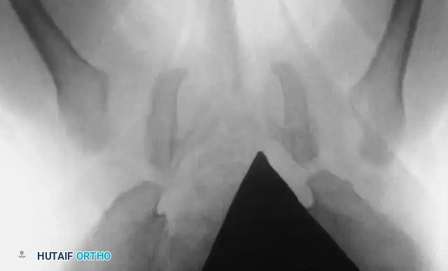 Hutaifortho's Orthopaedic Diagram