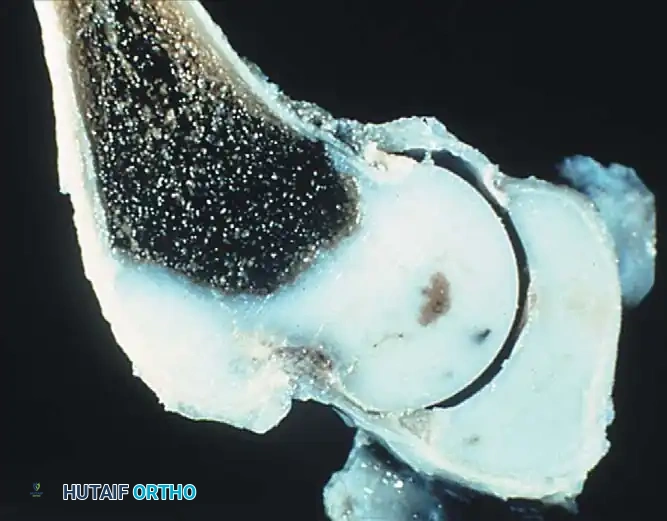 Hutaifortho's Orthopaedic Diagram