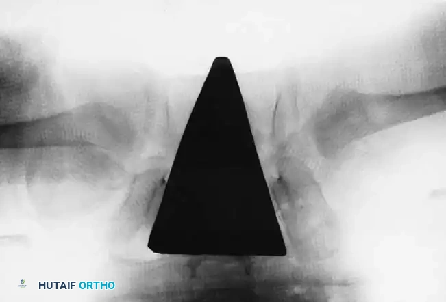 Hutaifortho's Orthopaedic Diagram
