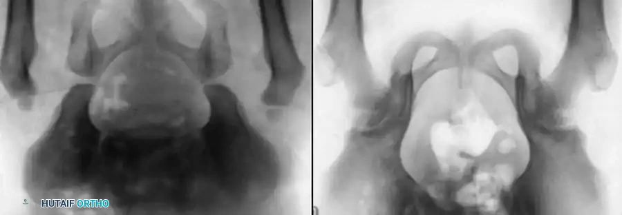 Hutaifortho's Orthopaedic Diagram