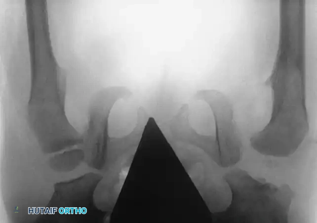 Hutaifortho's Orthopaedic Diagram