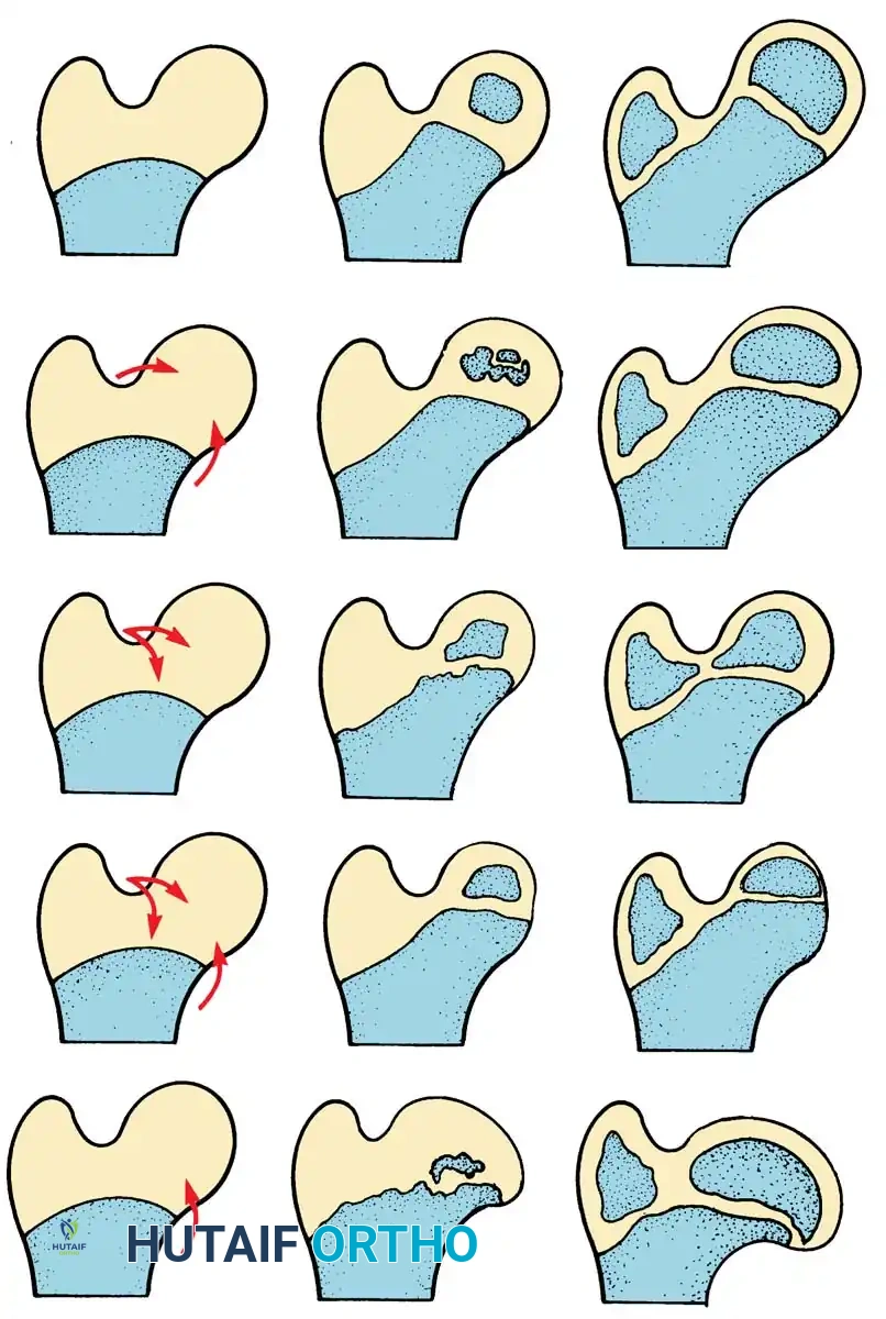 Hutaifortho's Orthopaedic Diagram