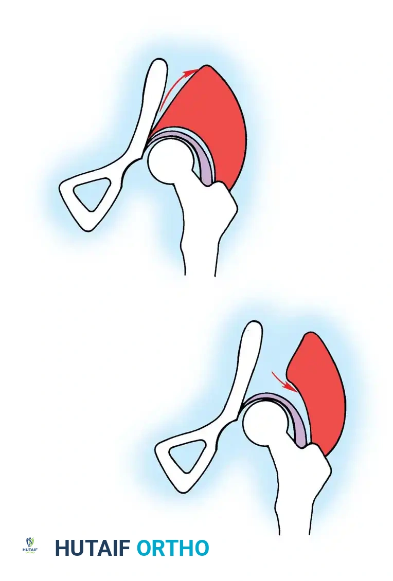 Hutaifortho's Orthopaedic Diagram