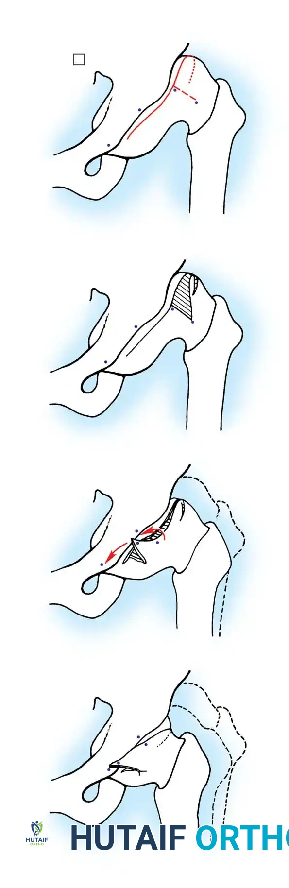 Hutaifortho's Orthopaedic Diagram