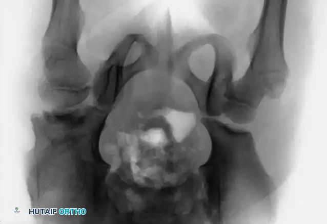Hutaifortho's Orthopaedic Diagram