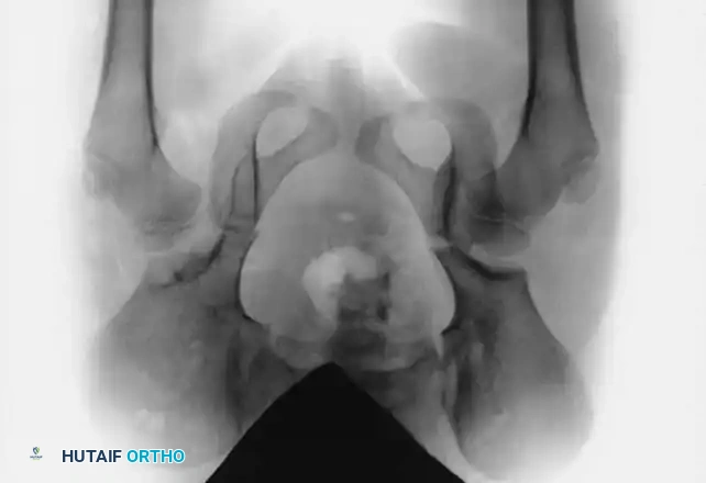 Hutaifortho's Orthopaedic Diagram