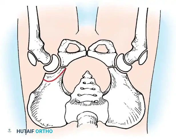 Hutaifortho's Orthopaedic Diagram