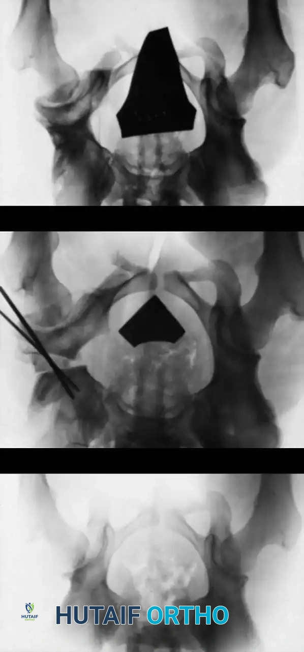 Hutaifortho's Orthopaedic Diagram