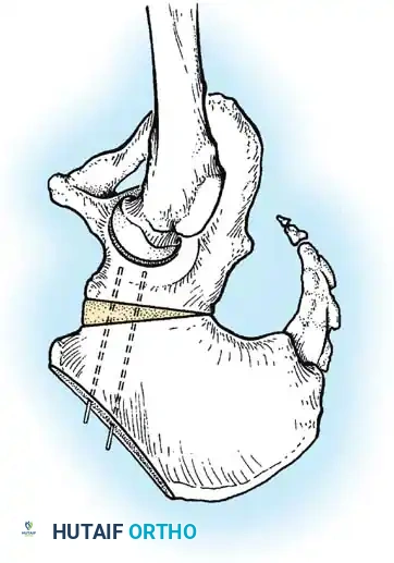 Hutaifortho's Orthopaedic Diagram