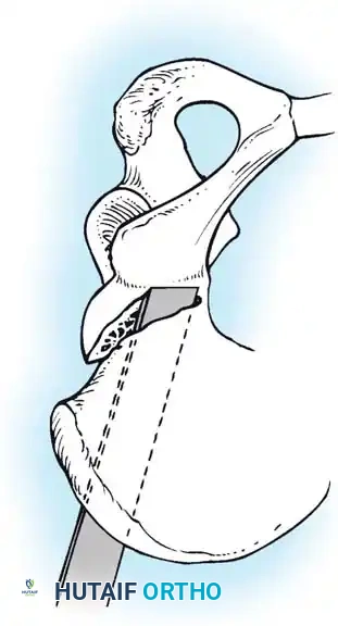 Hutaifortho's Orthopaedic Diagram