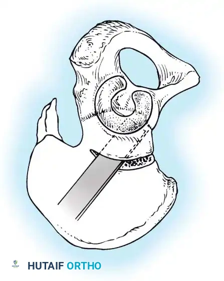 Hutaifortho's Orthopaedic Diagram