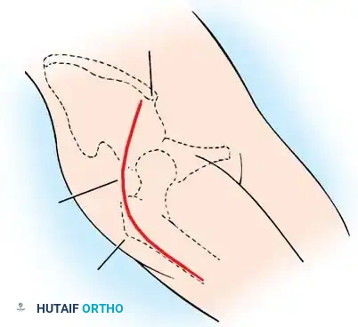 Hutaifortho's Orthopaedic Diagram