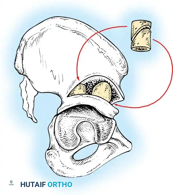 Hutaifortho's Orthopaedic Diagram