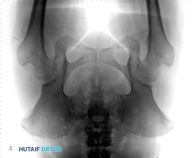 Hutaifortho's Orthopaedic Diagram
