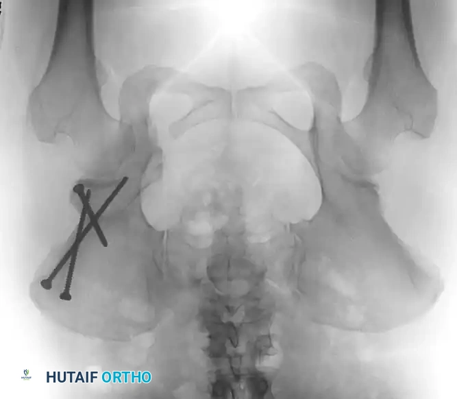Hutaifortho's Orthopaedic Diagram