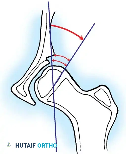 Hutaifortho's Orthopaedic Diagram