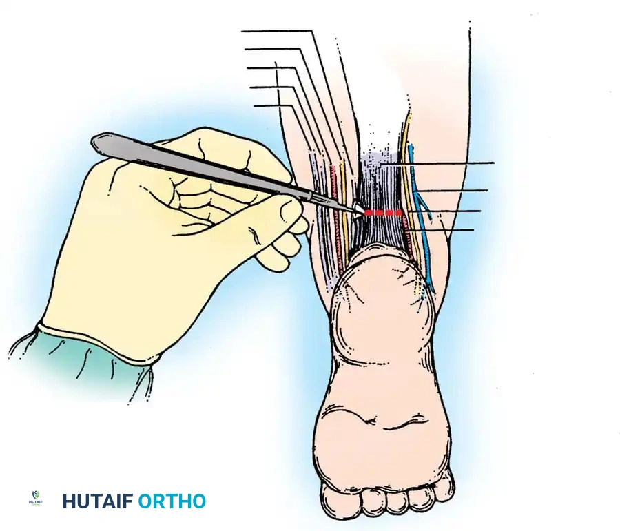 Hutaifortho's Orthopaedic Diagram