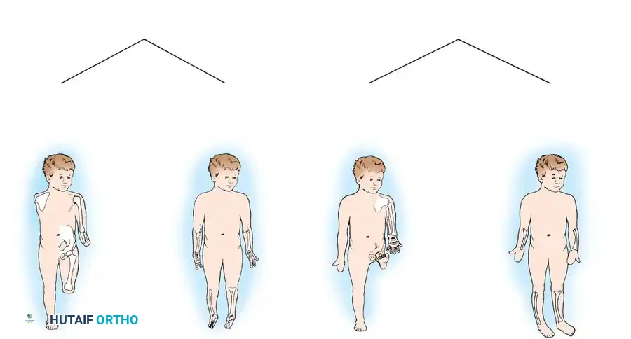 CONGENITAL DEFICIENCIES OF THE LONG BONES Surgical Diagram