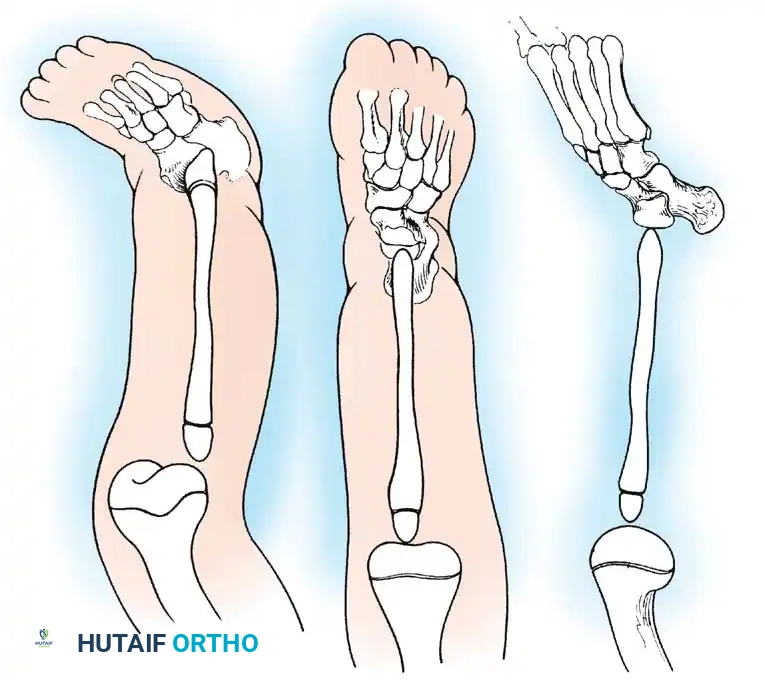 Hutaifortho's Orthopaedic Diagram