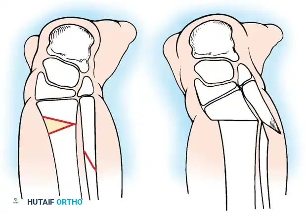 Hutaifortho's Orthopaedic Diagram
