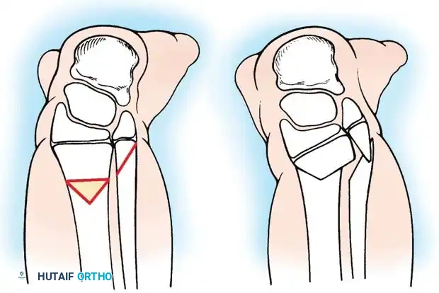 Hutaifortho's Orthopaedic Diagram