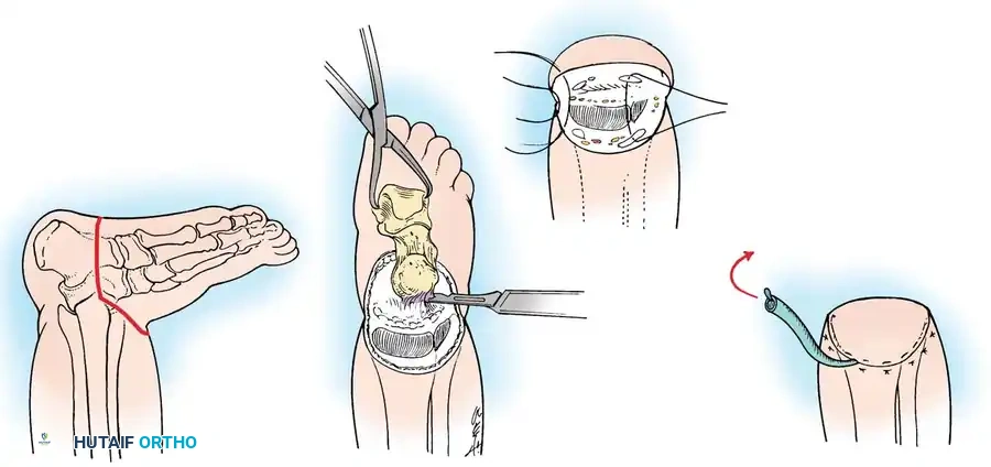 Hutaifortho's Orthopaedic Diagram