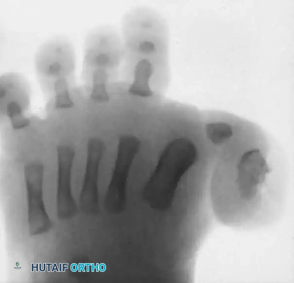 Postoperative Radiograph