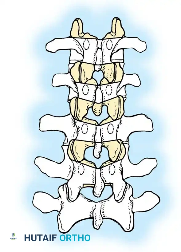 Pedicle Hook Placement