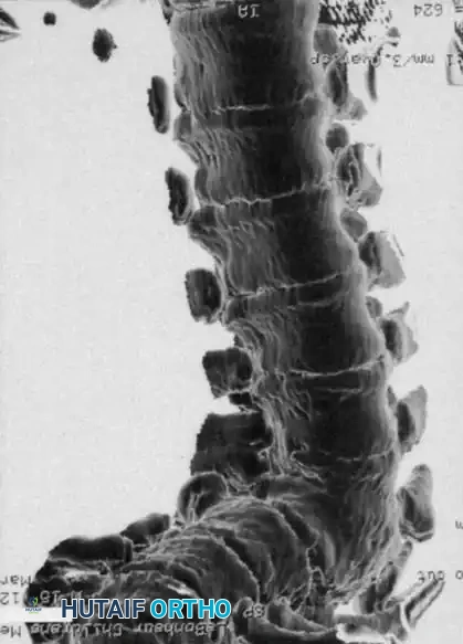 CT 3D Reconstruction D