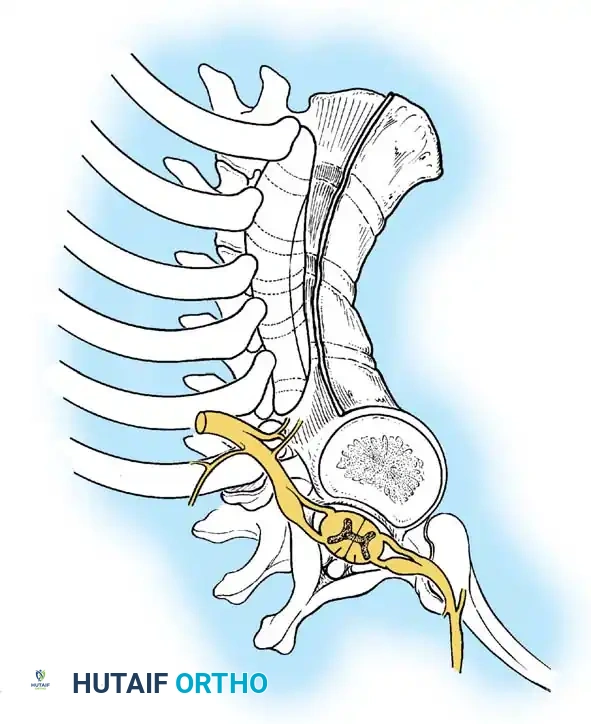 Surgical Diagram: Decortication