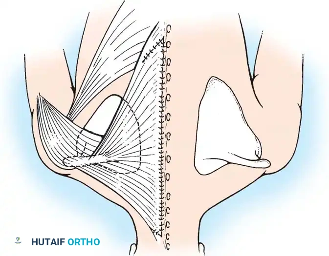 Hutaifortho's Orthopaedic Diagram