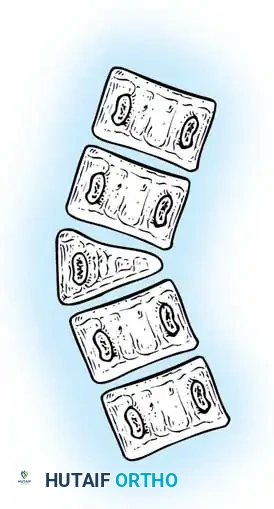 Hutaifortho's Orthopaedic Diagram