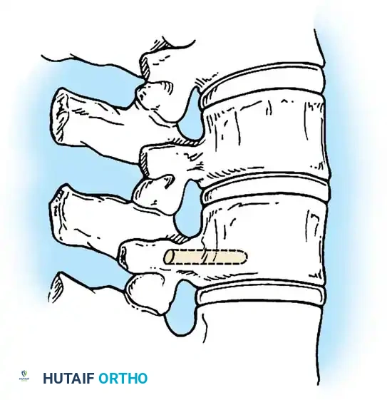 Hutaifortho's Orthopaedic Diagram
