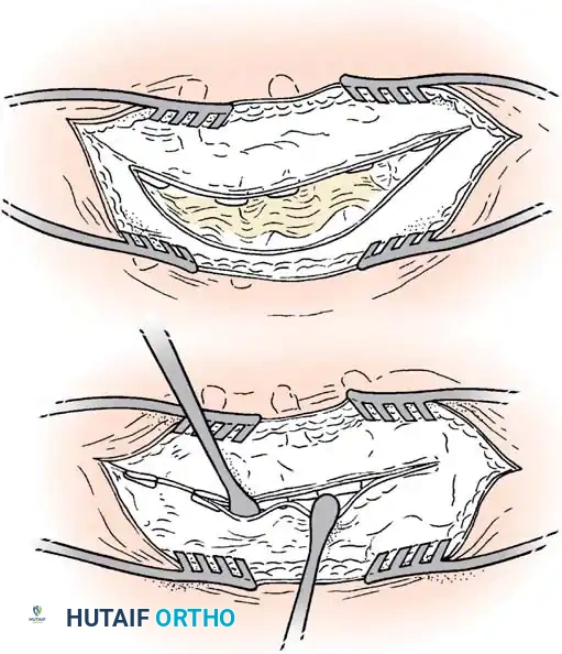 Hutaifortho's Orthopaedic Diagram
