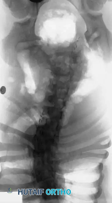 Hutaifortho's Orthopaedic Diagram