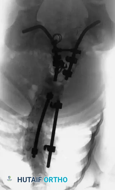 Hutaifortho's Orthopaedic Diagram