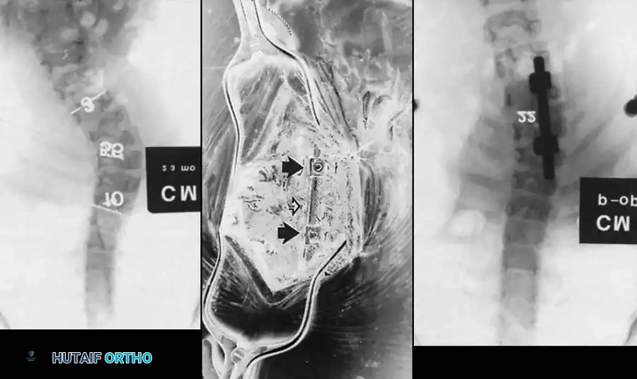 Hutaifortho's Orthopaedic Diagram