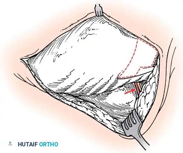 Hutaifortho's Orthopaedic Diagram