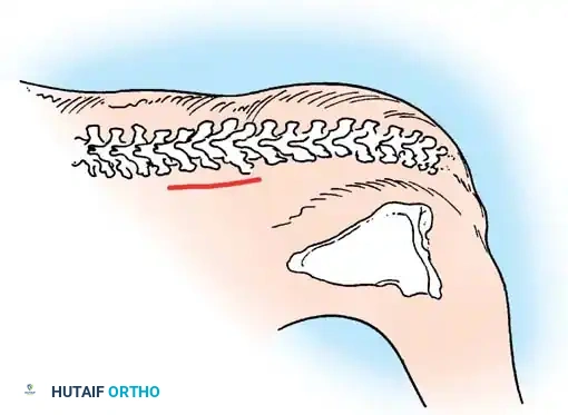 Hutaifortho's Orthopaedic Diagram