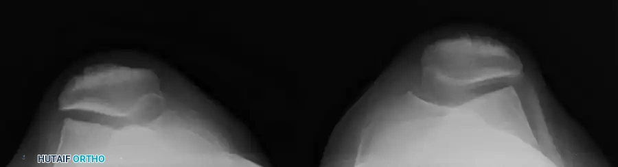 Hutaifortho's Orthopaedic Diagram