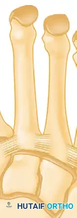 Lisfranc ligament (plantar structure)