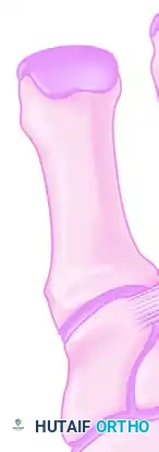 Lisfranc ligament (plantar structure)