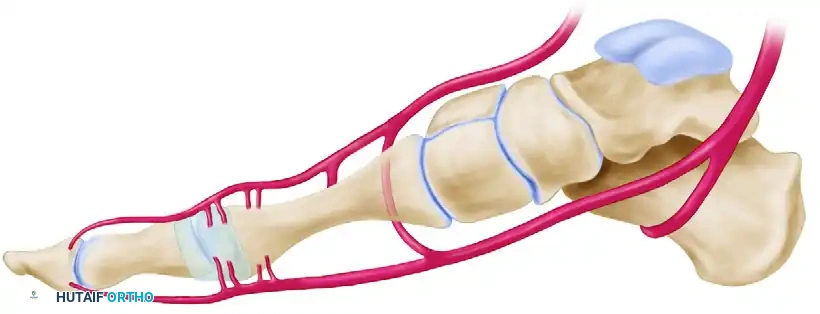 Safe zone for osteotomy Safe zone for lateral capsular release Osteotomy