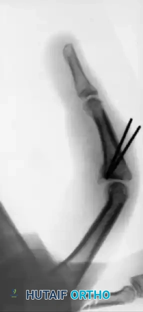 Hutaifortho's Orthopaedic Diagram